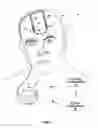 Fig. 02 - OPTICAL STIMULATION THERAPY
