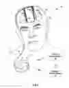 Fig. 06 - OPTICAL STIMULATION THERAPY