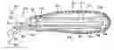 Fig. 01 - BRACHYTHERAPY DEVICES AND METHODS FOR THERAPEUTIC RADIATION PROCEDURES