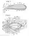 Fig. 02 - BRACHYTHERAPY DEVICES AND METHODS FOR THERAPEUTIC RADIATION PROCEDURES
