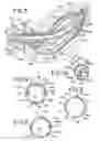 Fig. 03 - BRACHYTHERAPY DEVICES AND METHODS FOR THERAPEUTIC RADIATION PROCEDURES
