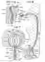 Fig. 04 - BRACHYTHERAPY DEVICES AND METHODS FOR THERAPEUTIC RADIATION PROCEDURES