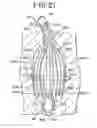Fig. 11 - BRACHYTHERAPY DEVICES AND METHODS FOR THERAPEUTIC RADIATION PROCEDURES
