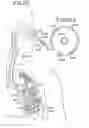 Fig. 12 - BRACHYTHERAPY DEVICES AND METHODS FOR THERAPEUTIC RADIATION PROCEDURES