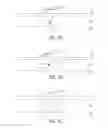 Fig. 05 - Methods and Systems for Tattoo Removal