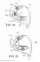 Fig. 07 - Golf club head having movable weights