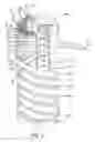Fig. 02 - Helically wrapped filter