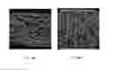 Fig. 07 - Filter media including oriented fibers