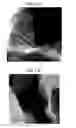 Fig. 02 - Ceria-zirconia complex oxide material and method for producing same
