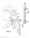 Fig. 04 - Paint roller assembly