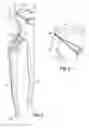 Fig. 02 - Torque grip slip force pliers