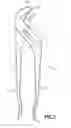 Fig. 03 - Torque grip slip force pliers
