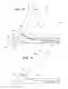 Fig. 08 - TENSION LOCKING TOOL