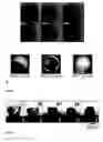 Fig. 05 - PROCESS AND DEVICE FOR PARTICLE SYNTHESIS ON A SUPERAMPHIPHOBIC OR SUPEROLEOPHOBIC SURFACE