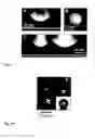 Fig. 07 - PROCESS AND DEVICE FOR PARTICLE SYNTHESIS ON A SUPERAMPHIPHOBIC OR SUPEROLEOPHOBIC SURFACE