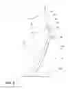 Fig. 03 - Power articulating headrest assembly