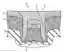 Fig. 01 - Multilayer component assembly for automobiles