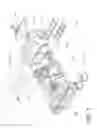 Fig. 08 - Robotic device for navigating inclined surfaces