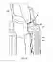 Fig. 49 - Or relating to closures