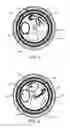 Fig. 05 - LID ASSEMBLY AND METHOD