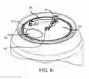 Fig. 08 - LID ASSEMBLY AND METHOD