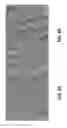 Fig. 09 - Silica support structure for a zeolite membrane