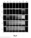 Fig. 10 - CLARIFICATION OF HYDROCARBONS AND SUSPENDED MATTER FROM AN AQUEOUS MEDIUM