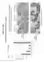 Fig. 16 - Methods of producing antibodies specific for p95