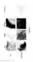 Fig. 08 - ADIPOSE-DERIVED STEM CELLS AND LATTICES