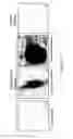 Fig. 19 - ADIPOSE-DERIVED STEM CELLS AND LATTICES