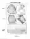 Fig. 20 - ADIPOSE-DERIVED STEM CELLS AND LATTICES