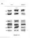 Fig. 41 - ADIPOSE-DERIVED STEM CELLS AND LATTICES