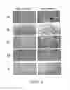 Fig. 64 - ADIPOSE-DERIVED STEM CELLS AND LATTICES