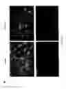 Fig. 70 - ADIPOSE-DERIVED STEM CELLS AND LATTICES