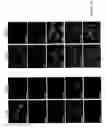 Fig. 85 - ADIPOSE-DERIVED STEM CELLS AND LATTICES