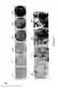 Fig. 91 - ADIPOSE-DERIVED STEM CELLS AND LATTICES
