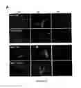 Fig. 92 - ADIPOSE-DERIVED STEM CELLS AND LATTICES