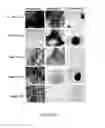 Fig. 96 - ADIPOSE-DERIVED STEM CELLS AND LATTICES