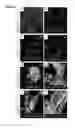 Fig. 06 - Pancreatic insulin-producing beta-cell lines derived from human pluripotent stem cells