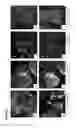 Fig. 22 - Pancreatic insulin-producing beta-cell lines derived from human pluripotent stem cells