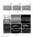 Fig. 06 - Method for engineering three-dimensional synthetic vascular networks through mechanical micromachining and mutable polymer micromolding