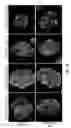 Fig. 07 - Minimal volume reprogramming of mononuclear cells
