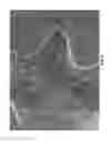 Fig. 07 - Endospore detection using hydrophobic collection material