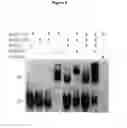Fig. 07 - METHOD TO PREDICT THE PATTERN OF LOCOMOTION IN HORSES