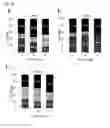 Fig. 08 - Analytical method for increasing susceptibility of molecular targeted therapy in hepatocellular carcinoma
