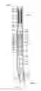 Fig. 03 - Down hole harmonic drive transmission