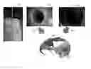 Fig. 01 - SYSTEMS AND METHODS FOR RECONSTRUCTING 3D SURFACES OF TUBULAR LUMENS