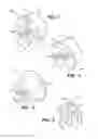 Fig. 03 - Protection shield positioning assembly and positioning device therefore and method of use