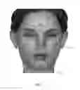 Fig. 03 - METHOD OF COLLECTING AND QUANTIFYING MELANIN IN SKIN