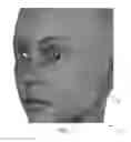 Fig. 04 - METHOD OF COLLECTING AND QUANTIFYING MELANIN IN SKIN
